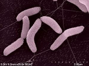 איור 2: Desulfovibrio Vulgaris - חיידק המחזר סולפאט לקבלת מימן גופרתי (2)